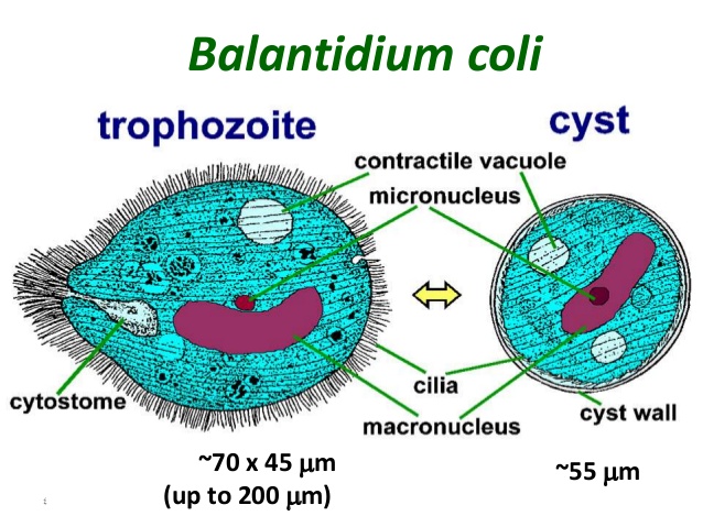 Szparkosz okrężnicy (Balantidium coli)