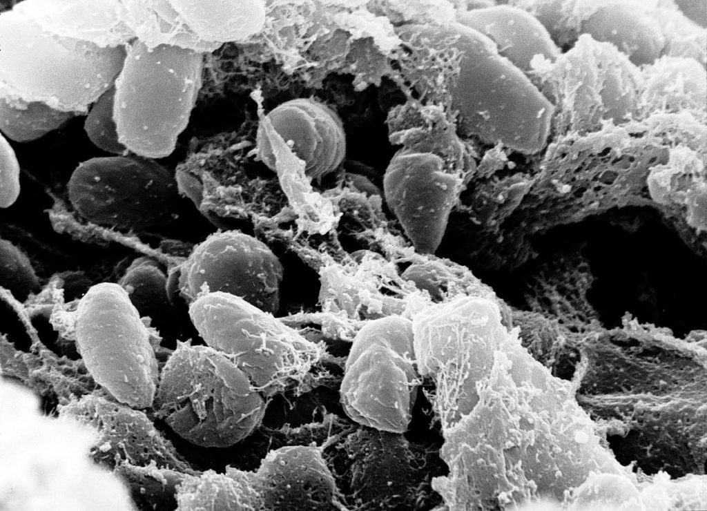 Bakterie Yersinia, prowadzą do choroby zakaźnej, mogącej mieć różny przebieg, uzależniony